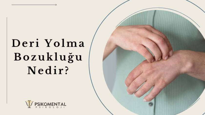 Deri Yolma Bozukluğu Nedir?